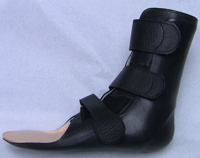 A custom-molded leather brace for ankle and hindfoot arthritis