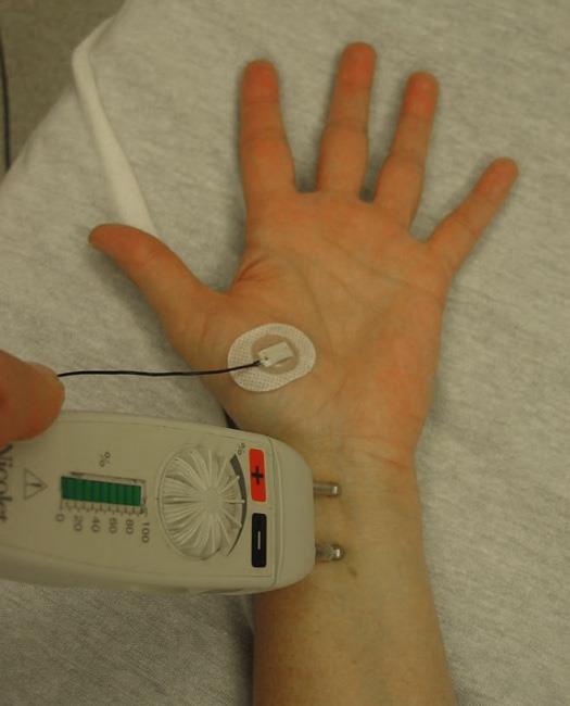 nerve conduction test for back pain