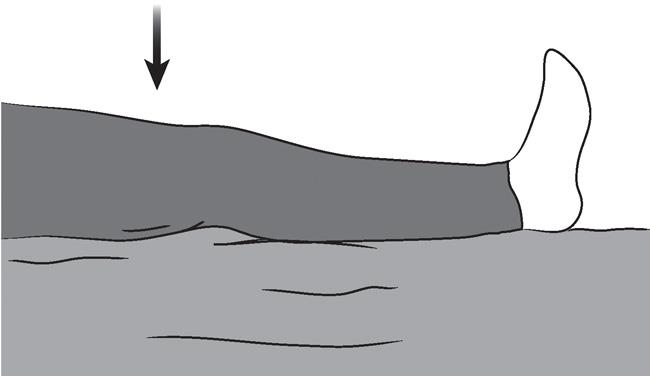 Illustration of quadriceps set