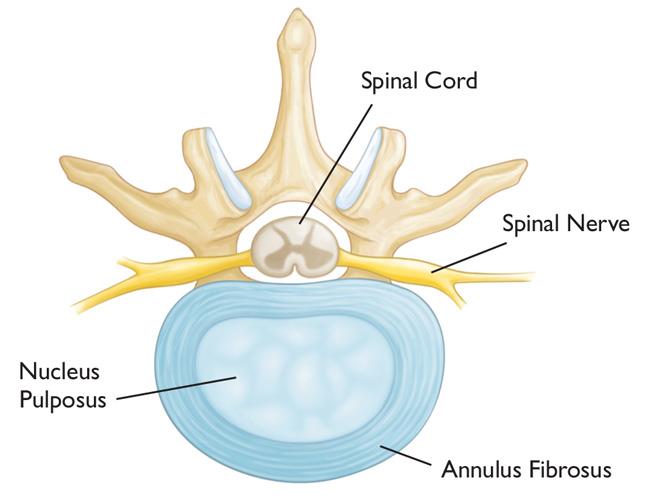 A healthy intervertebral disk (cross-section view). 