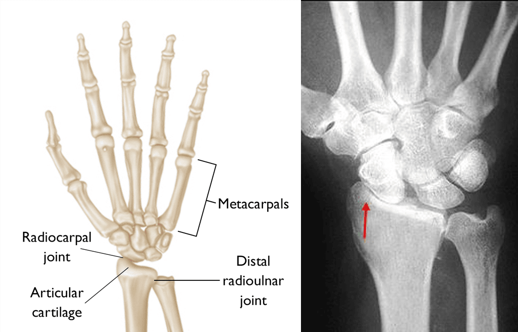 Wrist anatomy and osteoarthritis