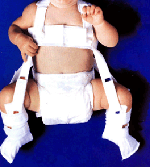 Baby in Pavlik harness