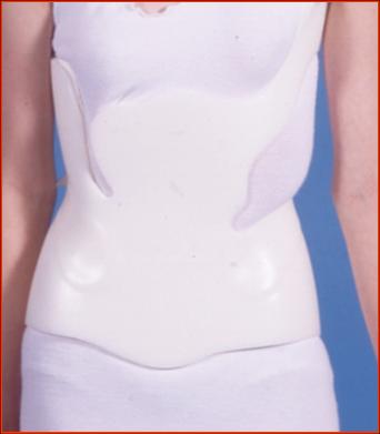 Clinical photo of a child wearing an underarm brace