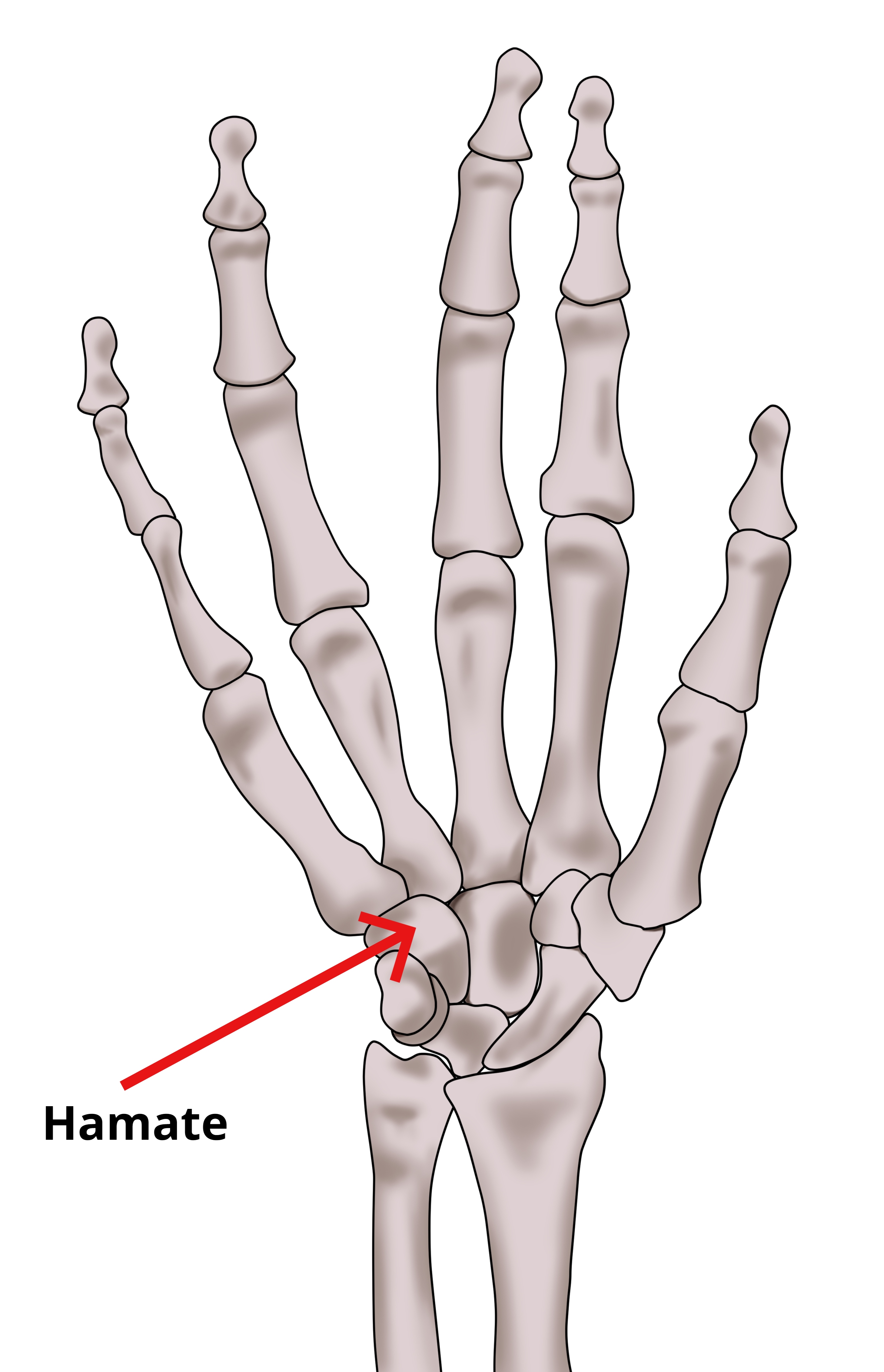 Hook of the Hamate Fracture of the Wrist - OrthoInfo - AAOS