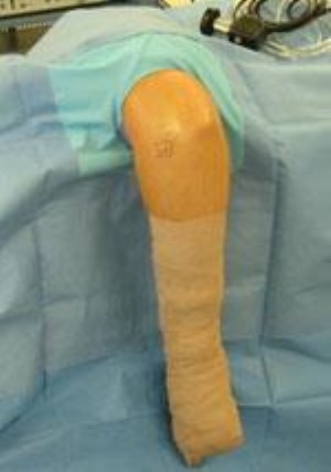 positioning for elbow surgery