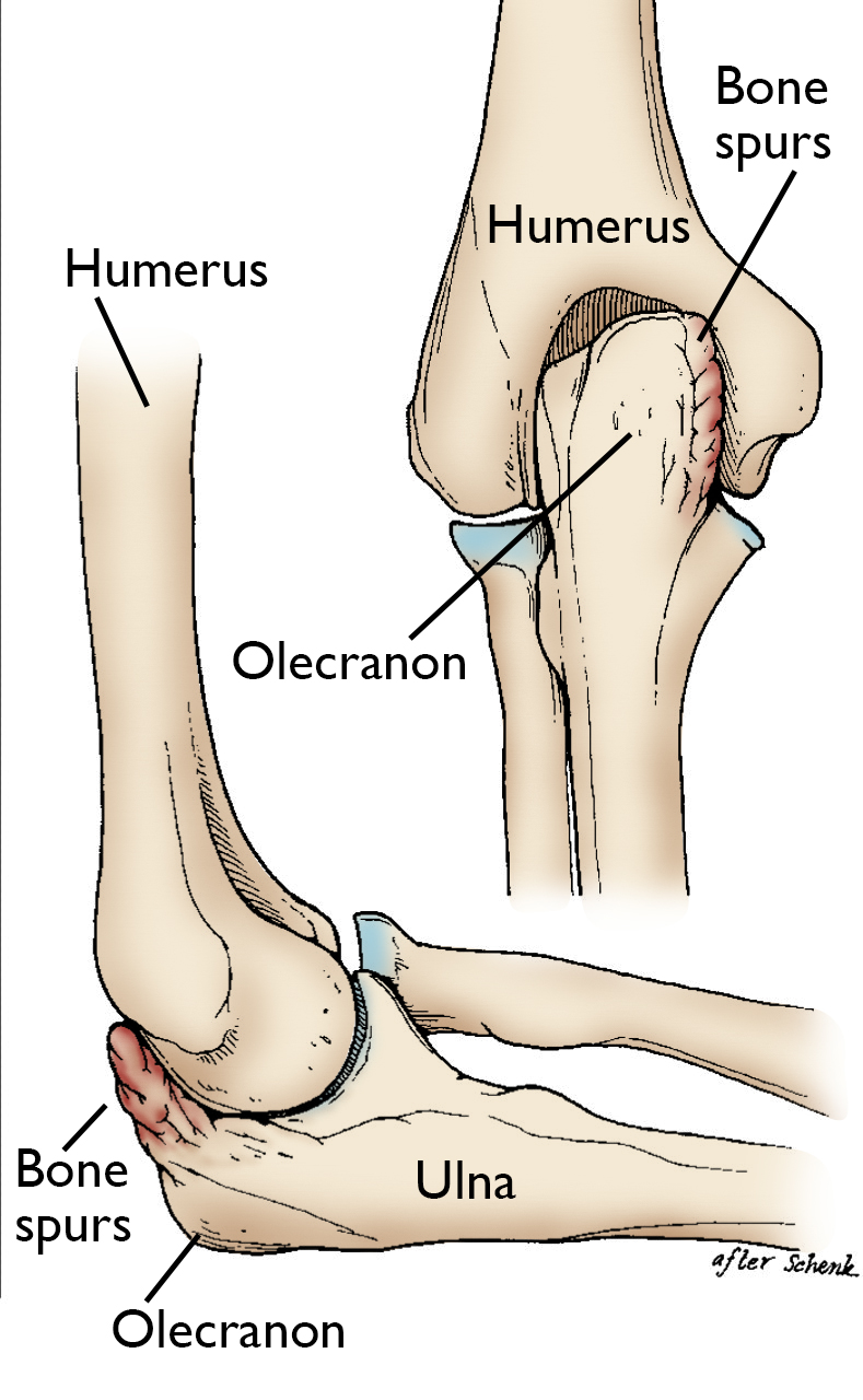 Valgus Extension Overload (VEO)