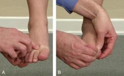 doctor examination of turf toe